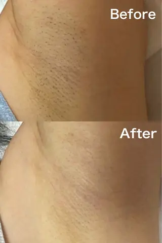 Lea Makana-レアマカナ所属・毛穴洗浄🍀脱毛🍀 光フェイシャル🍀のエステ・リラクイメージ