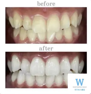 ホワイトニング ショップ本八幡店のエステ・リラクイメージ