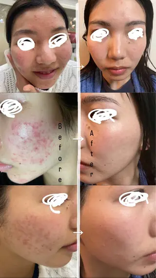 DeI’m西宮所属・都度払いエステ 清水桜子のエステ・リラクイメージ