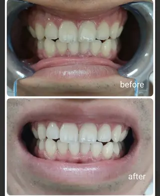 エクシアホワイト長野店所属・セルフホワイトニング エクシア長野店のその他イメージ