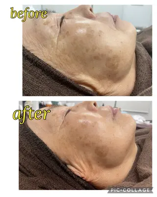 total beauty  salon RIRE所属・古川 弥生のエステ・リラクイメージ