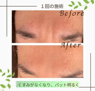 ニキビ改善サロン　縁樹　enju所属・ニキビ専門サロン縁樹 鈴木真樹のエステ・リラクイメージ