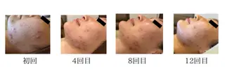 EstheticSalonReTweet所属・竹谷 春希のエステ・リラクイメージ
