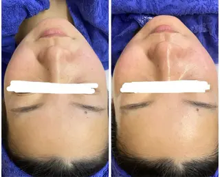 ビューティーサロン　プリズム所属・久留本 茜のエステ・リラクイメージ