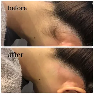 美肌脱毛・ハーブピーリング専門店Larin la beaute所属・Larin la beauteのエステ・リラクイメージ