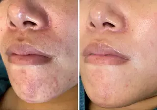 パーソナル肌質改善 🦋APRI🅿️有のエステ・リラクイメージ