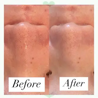 AY'S所属・倉敷/玉島/毛穴洗浄 古川碧のエステ・リラクイメージ