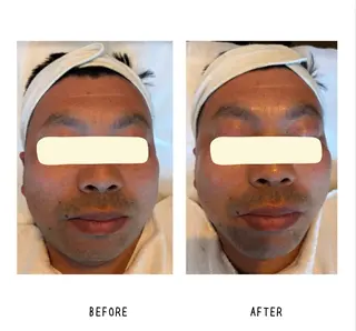 grow所属・Yoshino Erinaのエステ・リラクイメージ