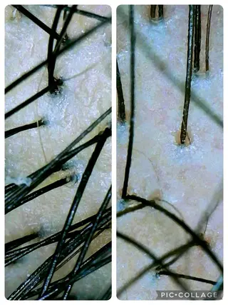 🅖🅤🅩🅔🅛 salonのエステ・リラクイメージ