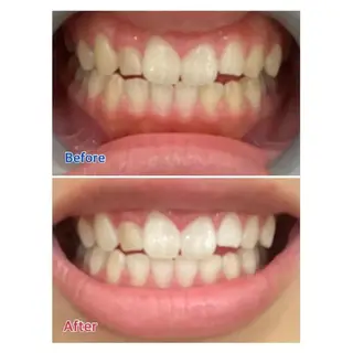 M渋谷店所属・M渋谷 ホワイトニングのエステ・リラクイメージ