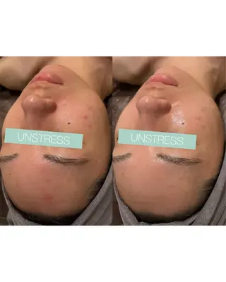 ☆痩身/小顔☆ 結果出します☆のエステ・リラクイメージ