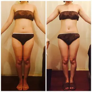 Cielo(シエロ) ダイエット専門店のエステ・リラクイメージ