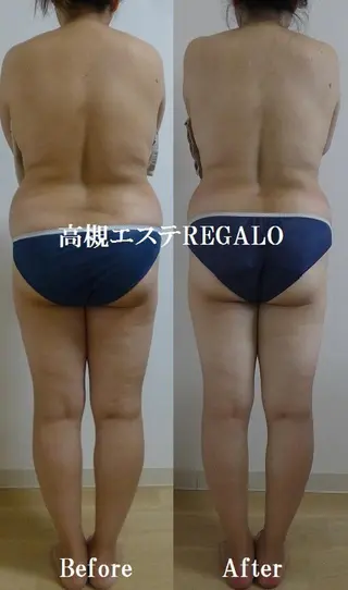 REGALO所属・矢野 さやかのエステ・リラクイメージ