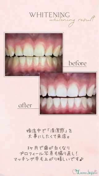 ホワイトニングサロンLuana-Sinfonia(エクシア)池袋店所属・セルフホワイトニング エクシア 池袋店のその他イメージ