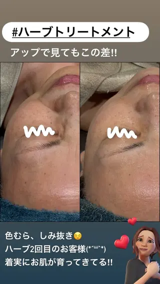 LiZA エステティックサロンのエステ・リラクイメージ