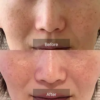 Charis エステ&ネイルのエステ・リラクイメージ