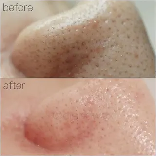 CLEAD 赤坂見附店のエステ・リラクイメージ