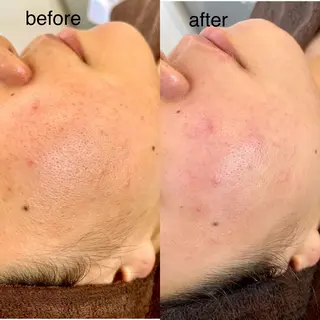 酵素エステ&糸脱毛 baby skinのエステ・リラクイメージ