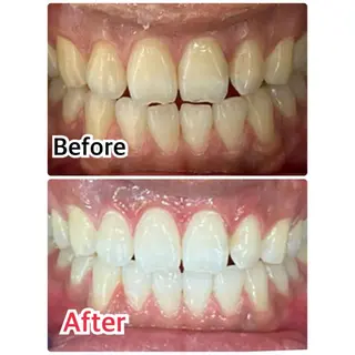 プラチナムビューティー柏所属・【歯科提携】柏ホワイ トニングスタイルのその他イメージ