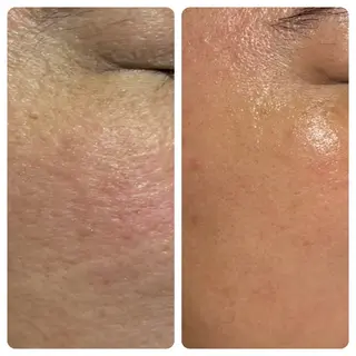 FLORALNOTE所属・ReCell 肌管理のエステ・リラクイメージ