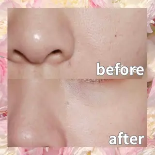 愛維美水光美肌専門店所属・愛維美水光美肌専門店 メンズレディースokのエステ・リラクイメージ