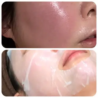 グリーンピール専門店 サロンY【大阪】のエステ・リラクイメージ