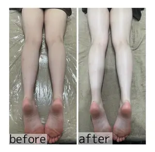 mimosa心斎橋所属・山﨑 諒のエステ・リラクイメージ