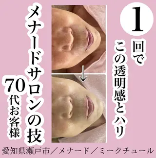 メナードフェイシャルサロン　ミークチュール所属・小顔｜毛穴ケア 後藤美里のエステ・リラクイメージ