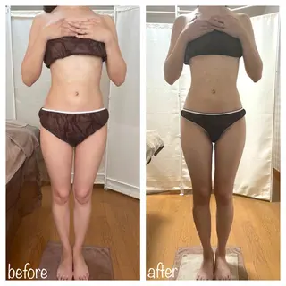 biloop所属・《痩身×疲労改善》 BILOOPのエステ・リラクイメージ