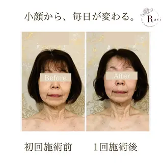 小顔サロンラヴィ　　船橋馬込沢店所属・小顔サロンラヴィ 船橋のエステ・リラクイメージ