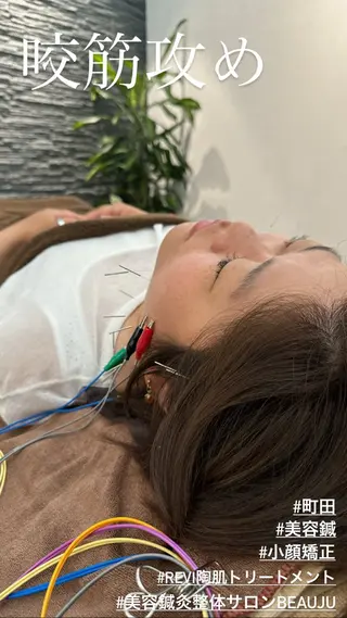 美容鍼灸整体サロンBeauJu所属・小顔矯/美容鍼/鍼灸 BeauJuのその他イメージ