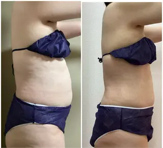 Brilliant所属・Brilliant 松原　エリカのエステ・リラクイメージ