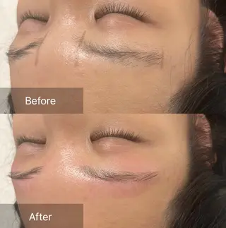 アイブロウ for woman所属・森 美優のエステ・リラクイメージ