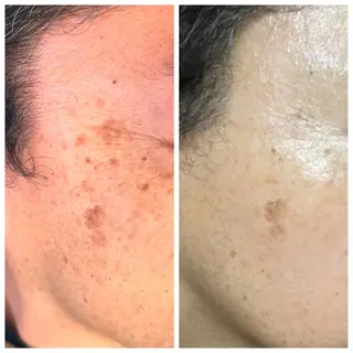 毛穴が見えなくなるサロン  Horo所属・岡 えり子のエステ・リラクイメージ