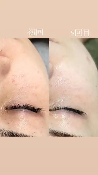 🆕✨　𝑬𝑹𝑰 南大塚の美肌改善のエステ・リラクイメージ