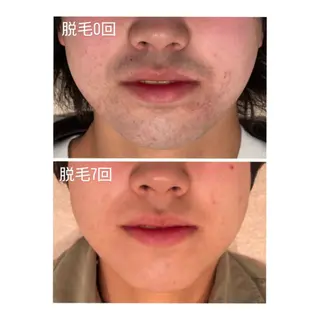 TotalBeautySalon UNCHEL所属・Ito ayakaのマツエク・マツパデザイン