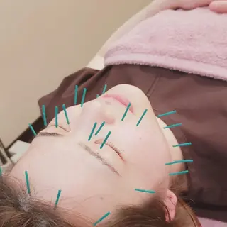 小顔美容鍼灸Acubelle Yakuin.【アキュベル薬院】所属・石川 真梨奈  美容鍼灸/アロマのエステ・リラクイメージ