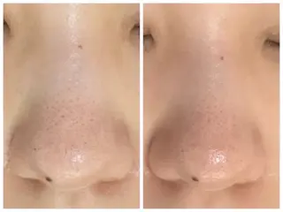 ハーブピーリング/ ララピール専門店のエステ・リラクイメージ