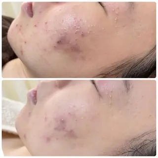 肌質改善サロン La Divinaのエステ・リラクイメージ