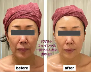 糸島 エステサロンmiuのエステ・リラクイメージ