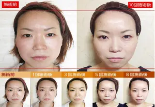 小顔整体研究所KSラボ福井店所属・田嶋 美里のエステ・リラクイメージ