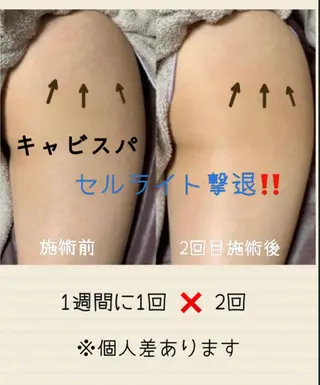 ヴィーナス ビューティーのエステ・リラクイメージ