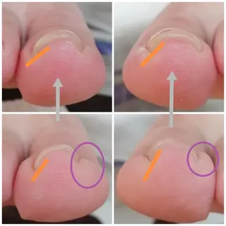 ネイル コエリネイル &エステのネイルデザイン