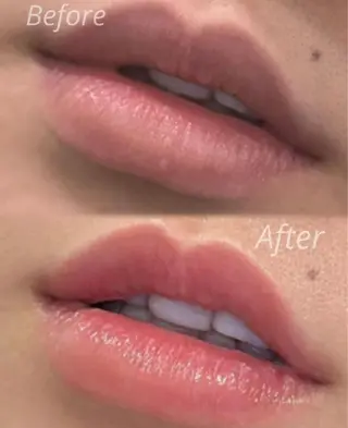 EstheticSalonReTweet所属・竹谷 春希のエステ・リラクイメージ