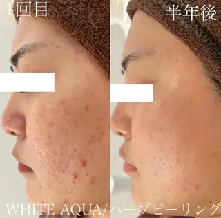 中目黒ハーブピーリン グ🌿ララピールのエステ・リラクイメージ