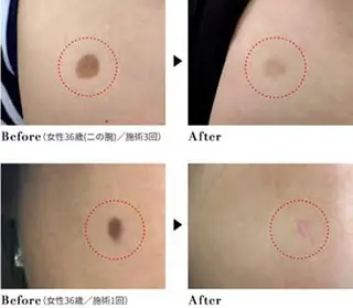 BestBelleꕤ 大阪福島/肌質改善のエステ・リラクイメージ