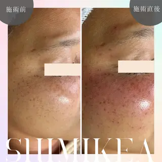 伊藤 稚菜のエステ・リラクイメージ