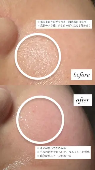 chouchou【シュシュ】所属・トータルボディケア chouchouのエステ・リラクイメージ