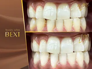 メンズ ビューティーサロンベクスト beautysalonBEXT所属・ビューティーサロン ベクスト名古屋のエステ・リラクイメージ