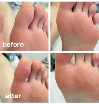 巻き爪フットケアサロンKotori所属・フットケアサロン Kotoriのその他イメージ